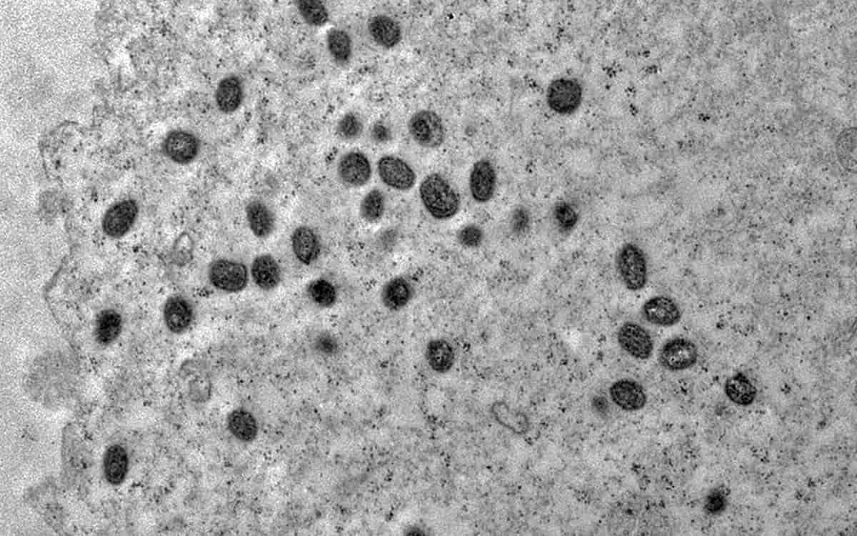 Foto: Débora F. Barreto-Vieira / IOC / Fiocruz / Agência Brasil